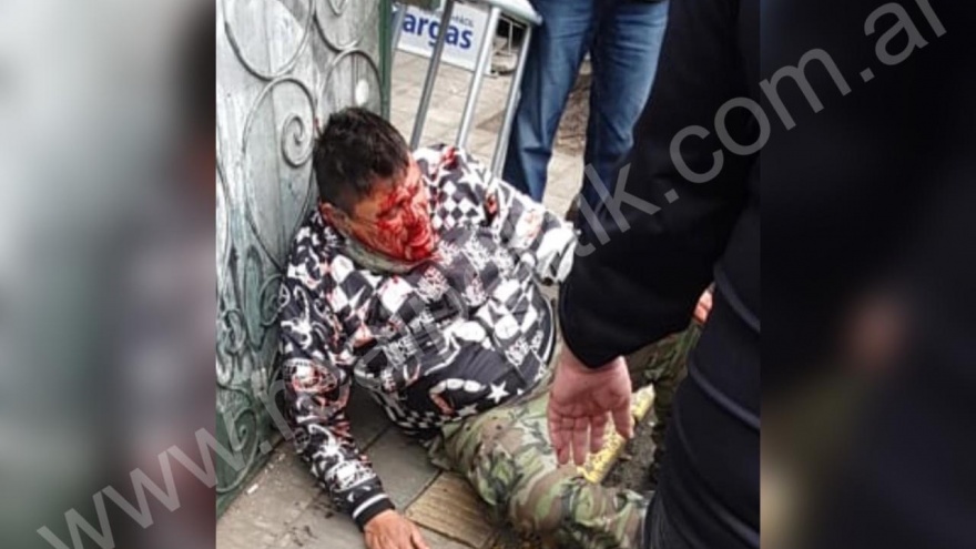 Aparecen fotos del “Hache” Alonso, tras ser golpeado a “fierrazos”