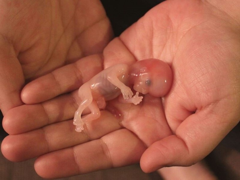 Trastornos post abortos: “El dolor no te lo quita nadie por el vínculo que se genera con el bebé”