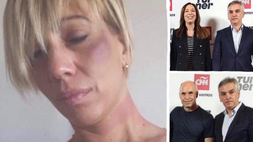 Políticos y periodistas se olvidaron de la sororidad y acompañaron al golpeador y dueño de CNN Argentina