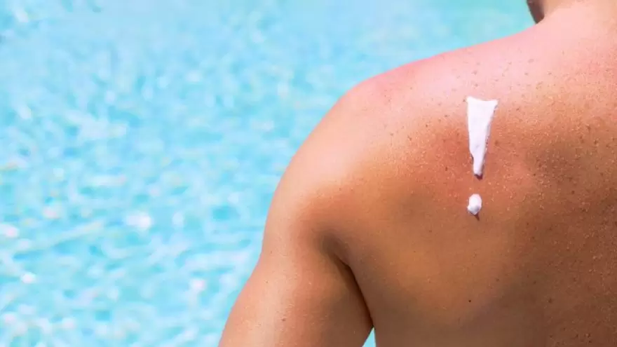 Cáncer de piel, una de las grandes preocupaciones en el verano: “Lo importante es la prevención”