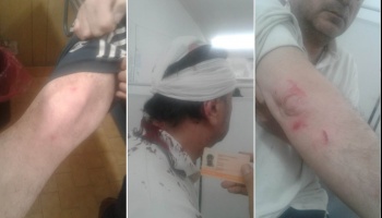 El sobrino y el hermano de Nedela desfiguraron a golpes a una persona discapacitada