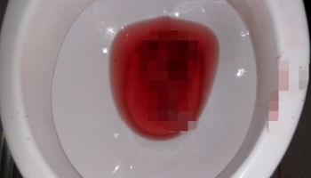 Aborto clandestino: Apareció un feto en un inodoro del hospital Evita Pueblo