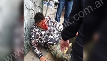 Aparecen fotos del “Hache” Alonso, tras ser golpeado a “fierrazos”