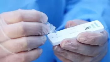 La Federación Bioquímica se opone a la venta libre de test de COVID-19