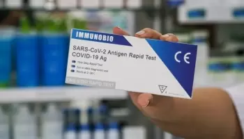 Autotest: Desde Farmacéuticos precisaron que “es muy raro que haya un falso positivo”