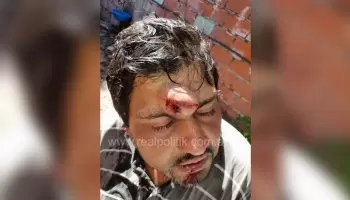 Florencio Varela: Se negó a comprarle medias y le partió un adoquín en la cabeza