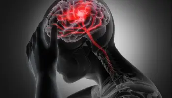 "El ACV no distingue edades: a cualquiera que tenga sangre, cerebro y arterias le puede pasar"